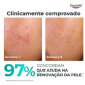 Gel Peeling 10 Eucerin DermoPure 40ml