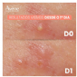 AVENE CLEANANCE COMEDOMED PEELING CREME ACELERADOR ANTIACNE 40M
