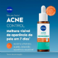 SRUM NIVEA REPARADOR DIARIO ACNE CONTROL 30ML